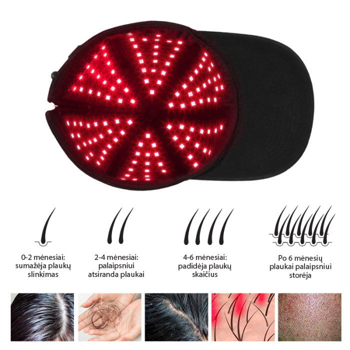 Kepuraite plaukams Be OSOM Red Light Therapy Cap Black BEOSOMREDLIGHTCAP skatinanti plauku augima 2